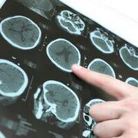 hii-ngeri-dokter-di-kenya-lakukan-operasi-otak-pada-pasien-yang-salah