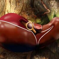 seorang-ibu-di-surabaya-jual-ginjal-demi-beli-ponsel-untuk-sang-anak