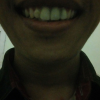 post-image
