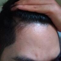 post-image
