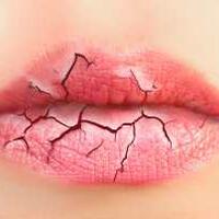 cara-merawat-bibir-kering-dan-pecah-pecah-mengelupas-cobain-yuk