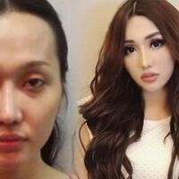 terungkap-di-negara-ini-lucinta-luna-lakukan-operasi-plastik-biayanya-fantastis