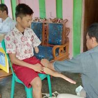 wajah-amin-berbinar-setelah-dapat-kaki-palsu