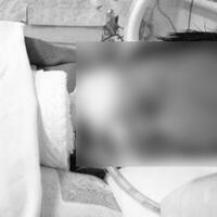 bayinya-dirawat-akibat-meningitis-nurul-dan-lenny-bingung-cari-uang-rp-250-juta