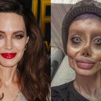 bikin-tercengang-ini-7-fakta-unik-operasi-plastik-di-korea-selatan