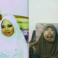 akhir-perjuangan-liyana-raziff-dan-suaminya-dalam-melawan-hipertiroid