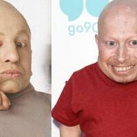 verne-troyer-aktor-mini-me-dalam-austin-powers-dan-harry-potter-meninggal-dunia