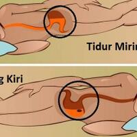 yang-mana-lebih-menyehatkan-tidur-miring-kiri-atau-miring-kanan