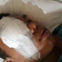 sakit-hati-selalu-tolak-perintah-atasan-tusuk-mata-anak-buahnya-di-tangerang