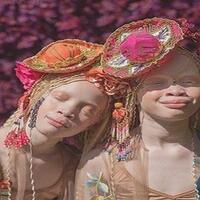 5-kisah-unik-saudara-kembar-di-dunia-salah-satunya-lahir-di-tahun-yang-berbeda