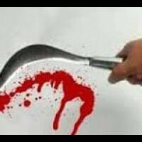 kelingking-putus-disabet-celurit-korban-pemalakan-tak-bisa-jadi-anggota-polri