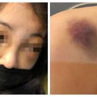 gara-gara-mendengkur-gadis-17-tahun-jadi-korban-penganiayaan-teman-sekamarnya