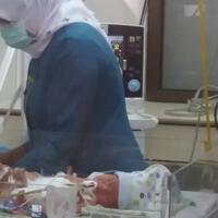 mengetahui-anaknya-kembar-siam-azis-tidak-akan-malu-untuk-membesarkan