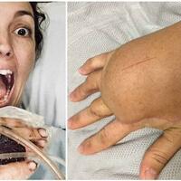 hanya-karena-goresan-kecil-saat-pindahan-rumah-wanita-ini-hampir-mati-secara-tragis