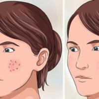 3-hal-sederhana-agar-pori-pori-wajah-mengecil