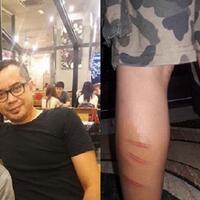 bocah-ini-izin-tidak-puasa-sang-ayah-pun-menangis-saat-tahu-anaknya-dicambuk-gurunya