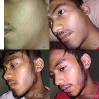 group-brewok-quotbrengozerquot-forum-resmi-berbagi-informasi-progress-hair-facial---part-1