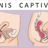 bagaimana-bisa-penis-terjebak-di-vagina-saat-berhubungan-seks