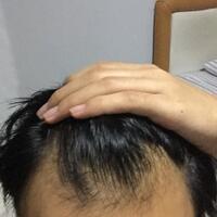 reborn-help-rambut-gua-rontok-hampir-botak