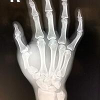 petarung-mma-favorit-dari-ufcstrikeforcebellator-dll-serta-event--nya---part-1