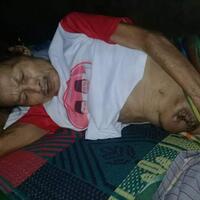 donasi-pak-penu-yang-terkena-penyakit-tumor-diperutnya