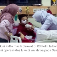 pulang-silaturahmi-muka-bocah-ini-luka-berat-akibat-dilempar-batu-di-depok