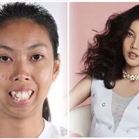 pencari-suaka-yaman-picu-kebencian-ras-di-korea-selatan