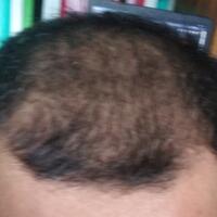 reborn-help-rambut-gua-rontok-hampir-botak