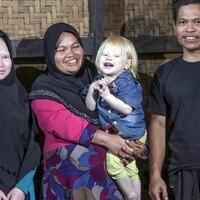 kisah-anak-albino-asal-ciburuy-hampir-mogok-sekolah-stop-bullying