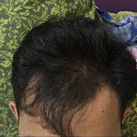 reborn-help-rambut-gua-rontok-hampir-botak