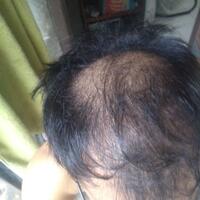 reborn-help-rambut-gua-rontok-hampir-botak