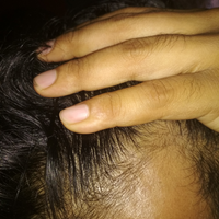 reborn-help-rambut-gua-rontok-hampir-botak