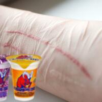 gara-gara-kecanduan-minuman-torpedo-56-pelajar-di-pekanbaru-nekat-sayat-tangannya