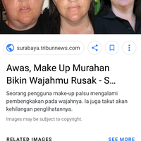 ratna-sarumpaet-dikeroyok-orang-tak-dikenal-prabowo-sandi-akan-jenguk