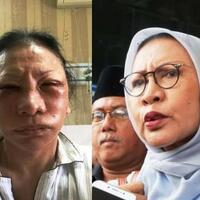 biaya-oplas-ratna-sarumpaet-bisa-bikin-2-tim-e-sport-gan