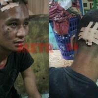fadli-bonyok-dikeroyok-12-orang-diikat-tiang-listrik--ditelanjangi--diseret-motor