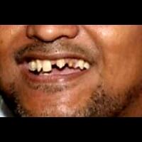 pagi-ini-amien-rais-dan-anaknya-diperiksa-di-polda-metro-jaya