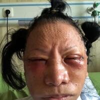 hargens-yang-bikin-kasus-ratna-sarumpaet-jadi-politis-adalah-konferensi-pers-prabowo