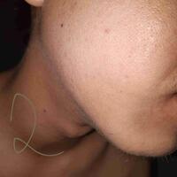 group-brewok-quotbrengozerquot-forum-resmi-berbagi-informasi-progress-hair-facial---part-1