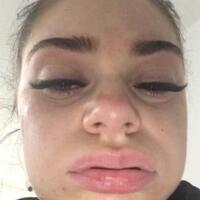 hati-hati-mahasiswi-ini-alami-hal-mengerikan-karena-ekstensi-bulu-mata