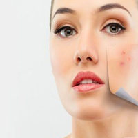 duh-ini-4-hal-yang-menyebabkan-noda-hitam-di-wajah