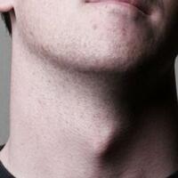 tahukah-ente-bahwa-jakun-mempunyai-manfaat