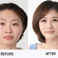 miris-escape-the-corsetquotprotes-wanita-koreaquot-karena-standar-kecantikan-yang-tinggi