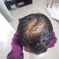 reborn-help-rambut-gua-rontok-hampir-botak