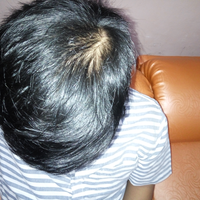 reborn-help-rambut-gua-rontok-hampir-botak