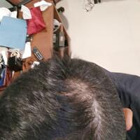 post-image