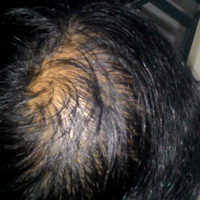 post-image