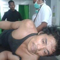 ditembak-polisi-saat-mencuri-motor-pak-guru-parulian-hanya-bisa-meringis