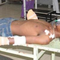 gara-gara-sentuh-organ-intim-istrinya-lelaki-ini-nekat-potong-tangan-saudara-iparnya