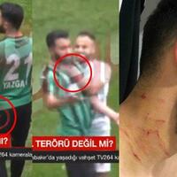 horor-di-laga-sepak-bola-turki-pemain-bawa-silet-untuk-lukai-pemain-lawan